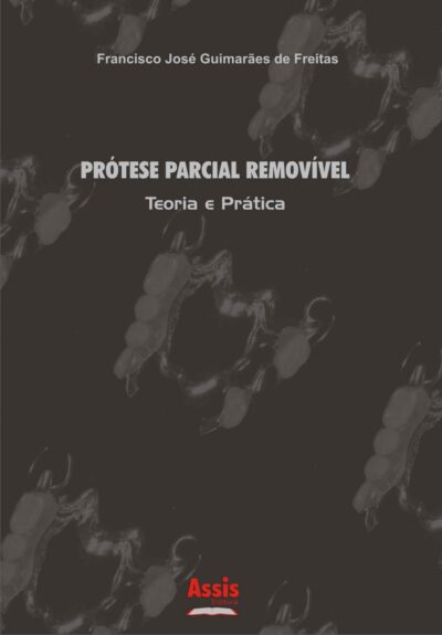 Prótese Parcial Removível: teoria e prática
